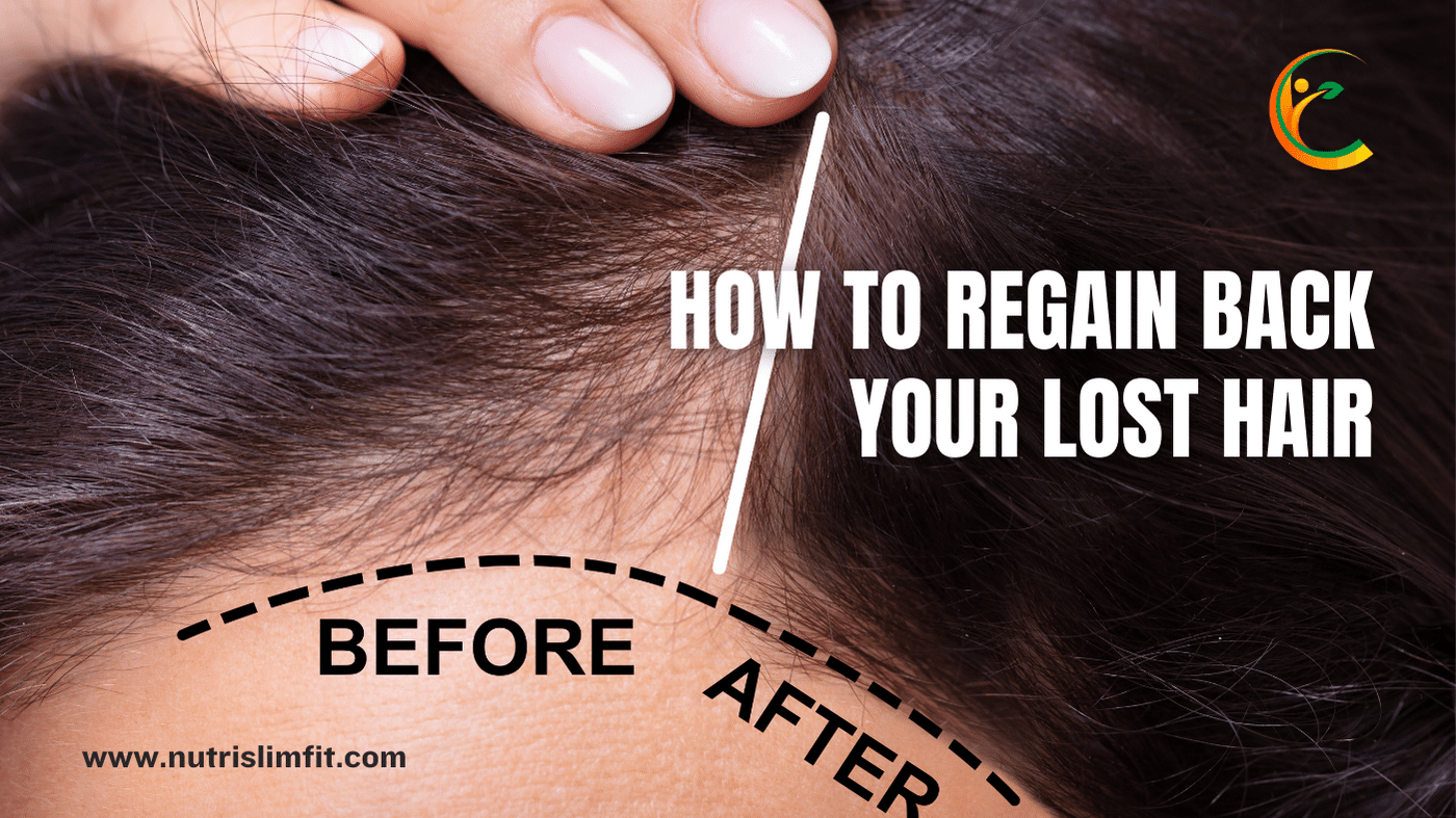 how-to-regain-lost-hair-best-method-to-regain-hair