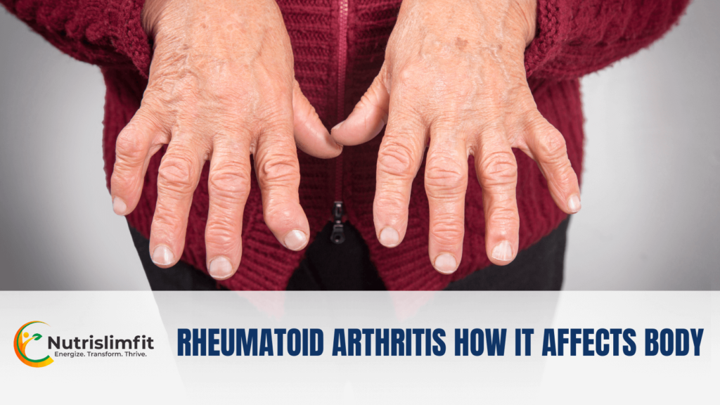 Rheumatoid Arthritis how it affects body