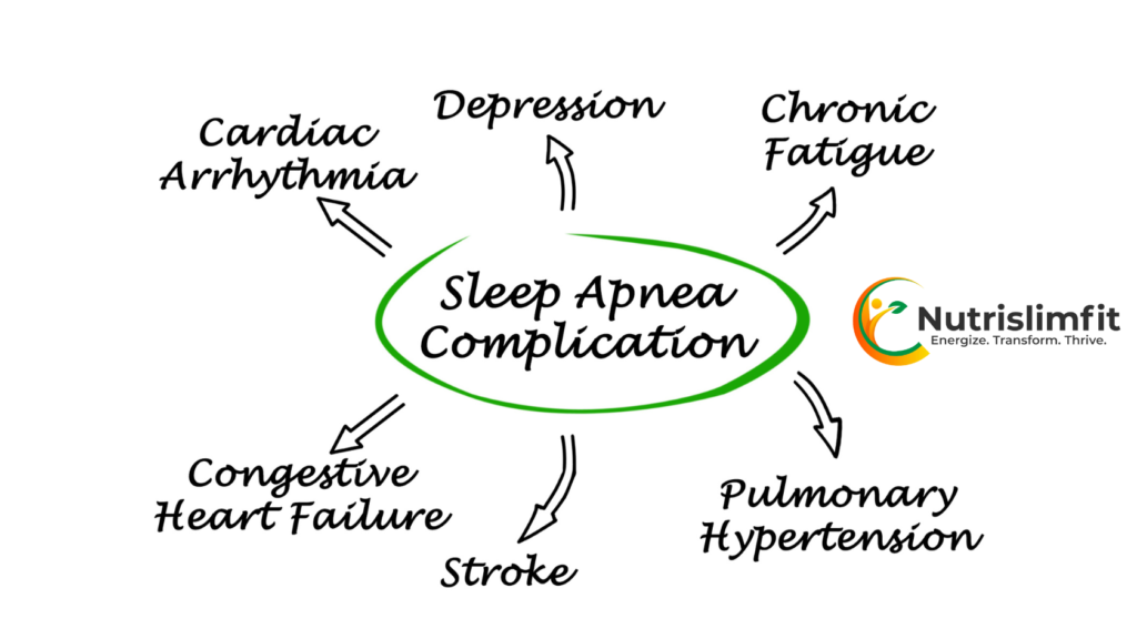 Understanding Obstructive Sleep Apnea: A Comprehensive Guide